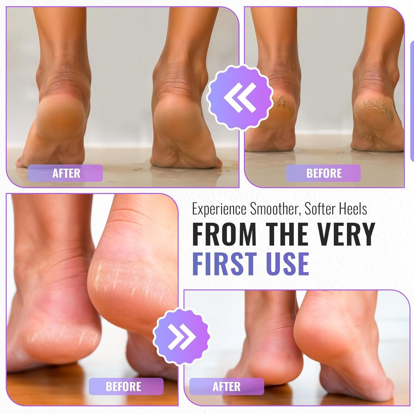 TYGA Foot Rasp Foot File and Callus Remover - Pedicure Tool for Dead Skin Removal, Feet Hard Skin Remover, Foot Scraper, Can Be Used on Both Wet and Dry Feet, Surgical Grade Stainless Steel File.