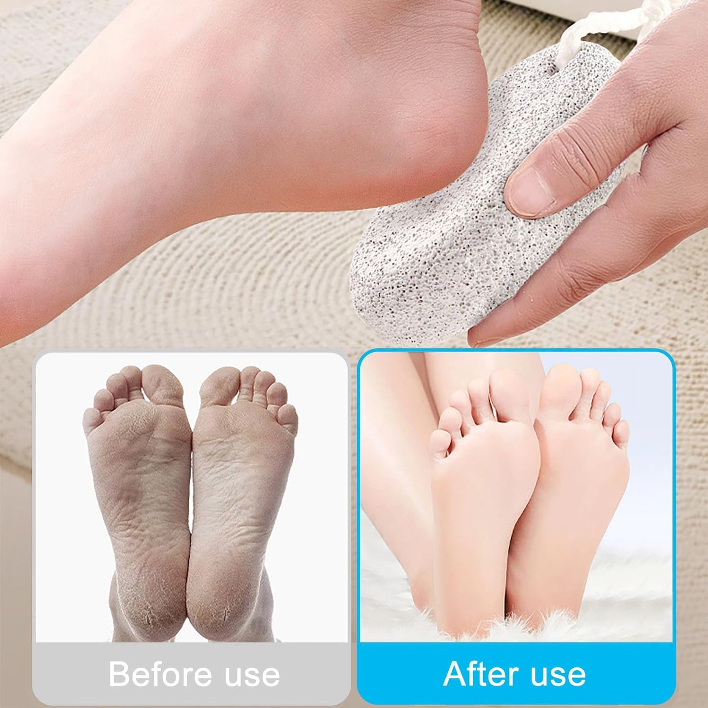 zoerbufan Pumice Stone for Feet/Hands/Body, Natural Lava Pumice Stone for Dead Hard Skin Removal, Foot Scrubber, White Calluse Remover, Foot File for Men/Women for Exfoliation