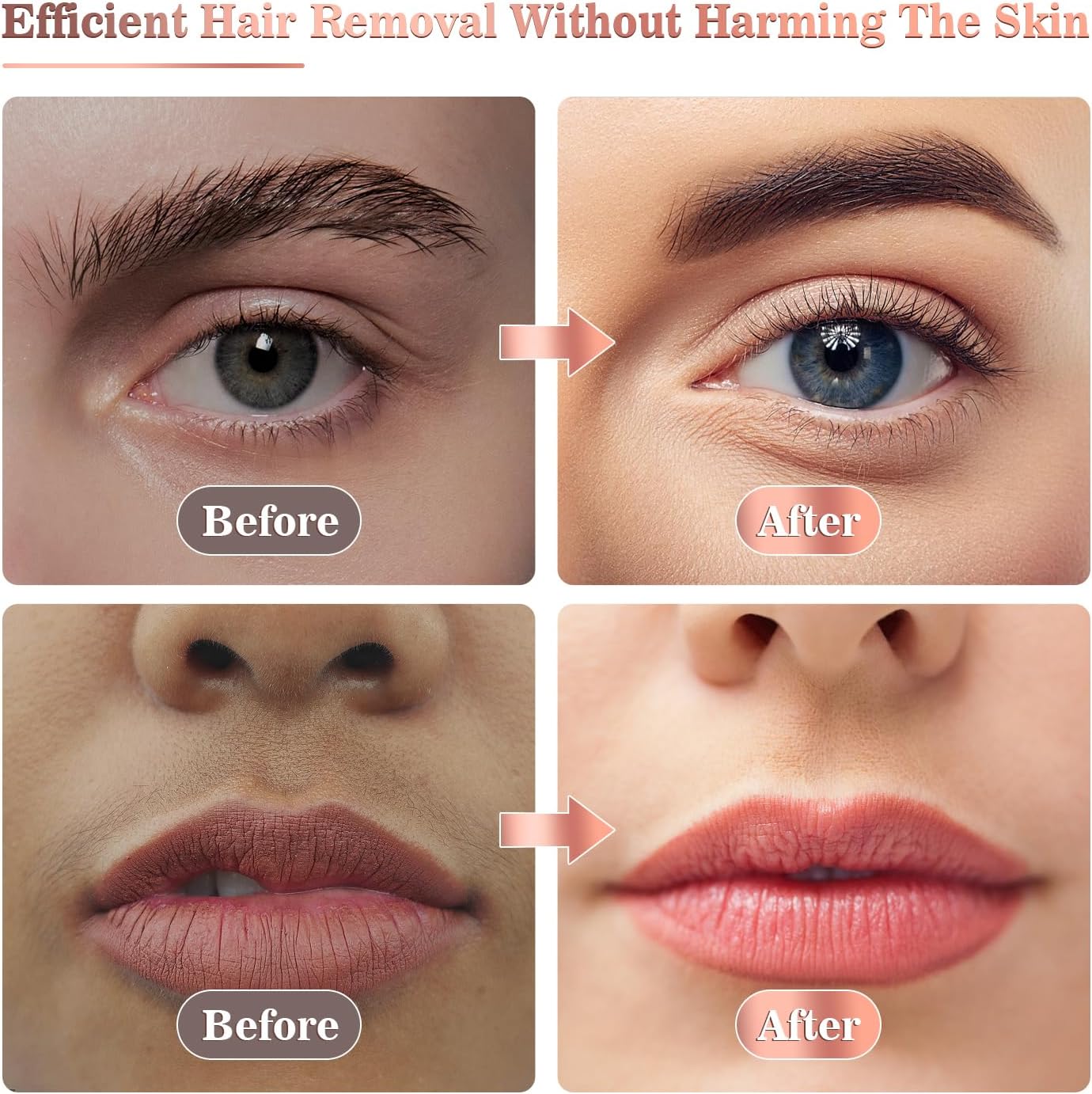 Vexloria Facial Hair Remover for Women, Face Hair Trimmer, Rechargeable Women's Facial Shaver, Painless Lady Shavers for Women for Face Hair, Upper Lips, Peach Fuzz, Bikini Body-White