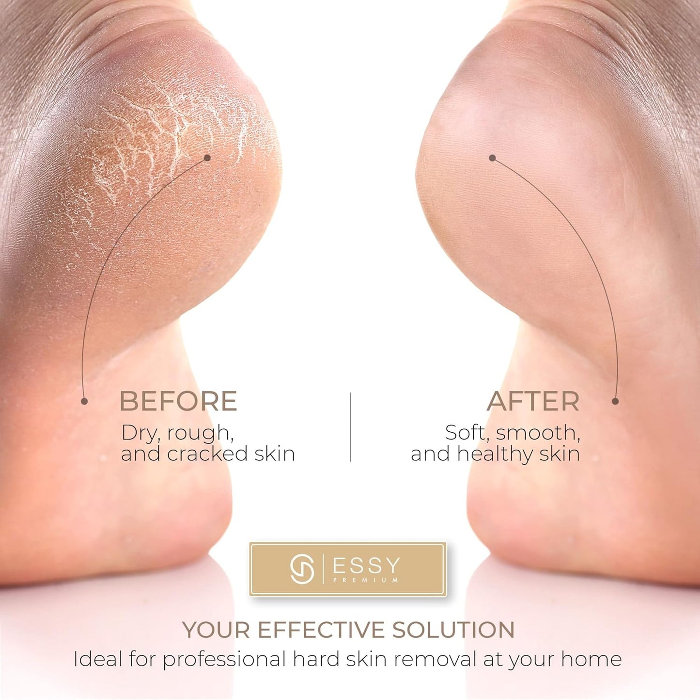 Essy Electric Foot File with 5 Replacement Rollers – Pedicure Tool for Smooth Feet, Ideal for Dry and Rough Skin Care (White)